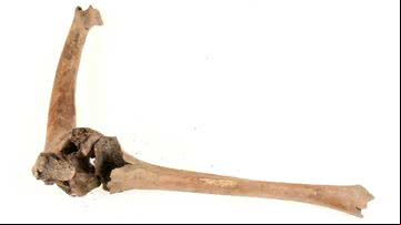Fratura femoral analisada em estudo - Divulgação/Museu Cultural de Lund/Nelly Hercberg