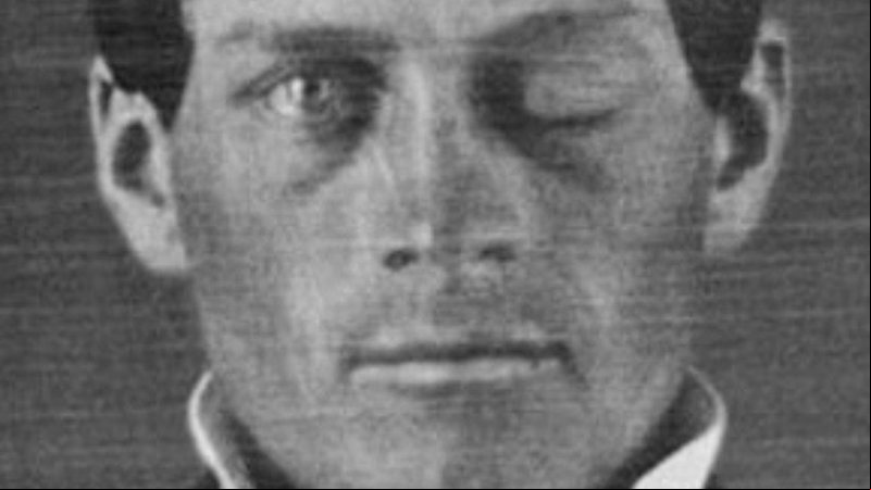 Retrato de Phineas Gage - Jack e Beverly Wilgus / Warren Anatomical Museum / Harvard Medical School / Wikimedia Commons